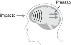 imagem demonstrando que a parte frontal da cabeça recebe o impacto e a parte traseira recebe a pressão